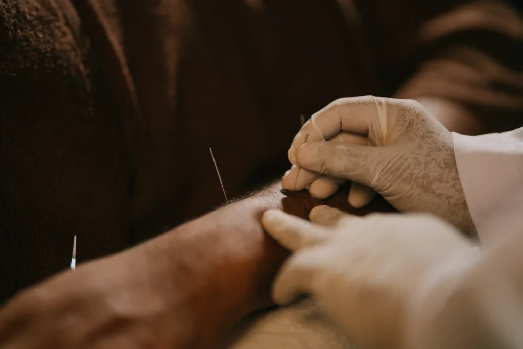 How Acupuncture Therapy Supports Natural Pain Management and Whole-Body Healing