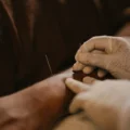 How Acupuncture Therapy Supports Natural Pain Management and Whole-Body Healing